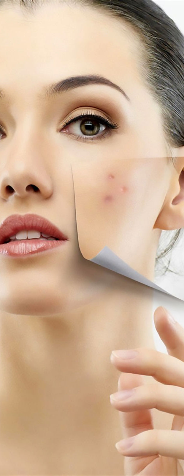 Woman applying a hydrocolloid acne patch to her cheek